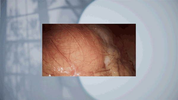 13.gif