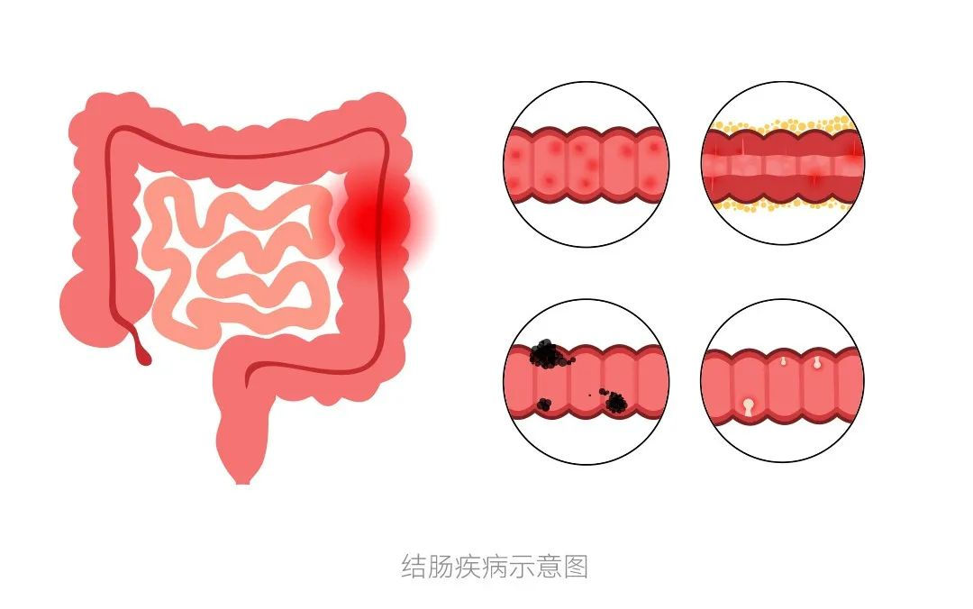 图片.png 图片.png